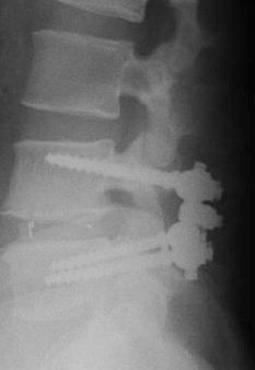 Spine-1_zps449cdf51.jpg