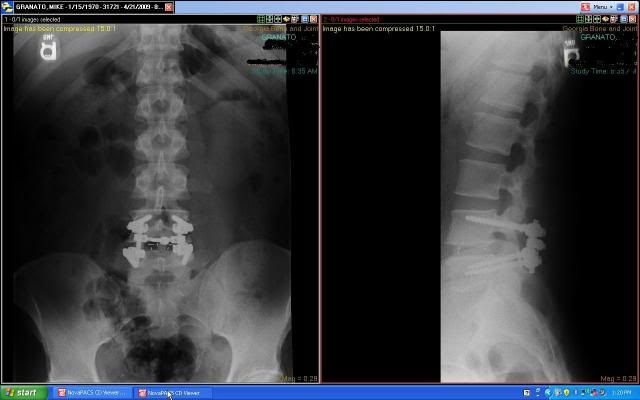 Spine.jpg